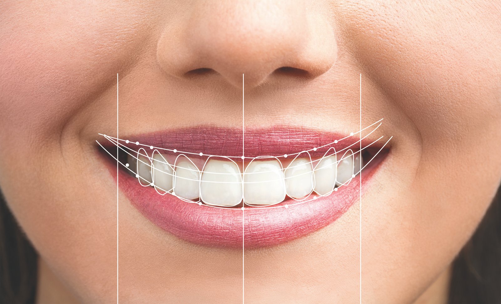 Cosmetic Dentistry