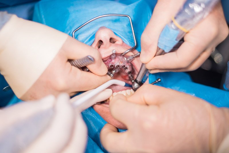 Oral surgeon1