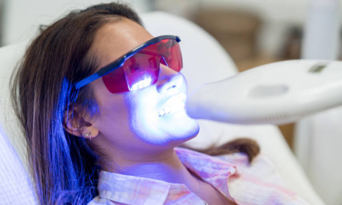 Teeth Whitening