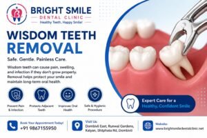 Wisdom Tooth Extraction